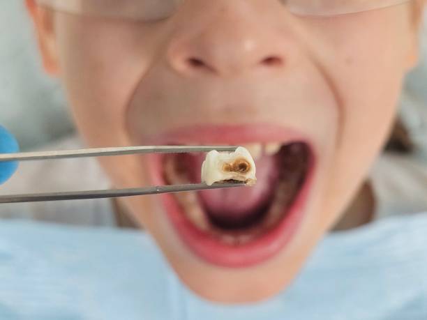 Best Orthodontic Emergency Dentist in Salinas, CA